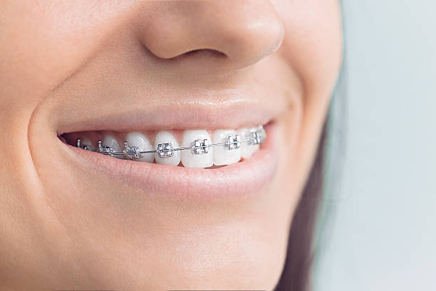 Full Mouth Reconstruction in Sac City, IA